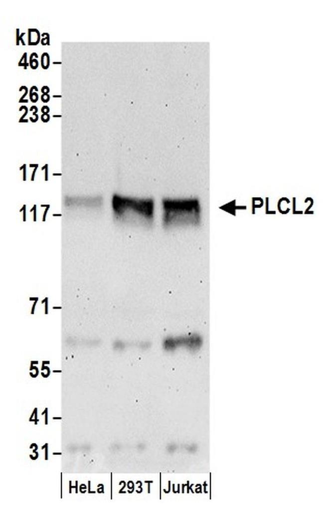 PLCL2 Antibody in Western Blot (WB)