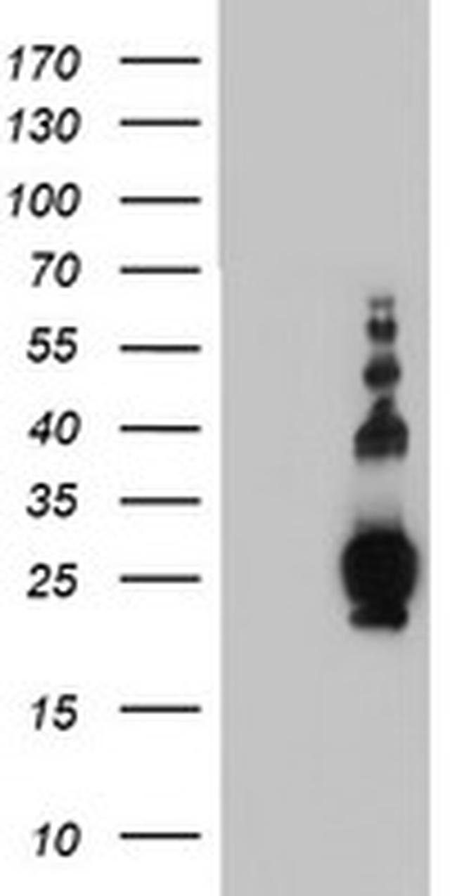 PLDN Antibody in Western Blot (WB)