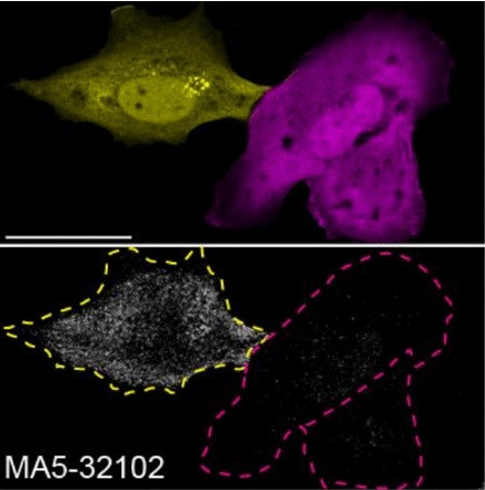 Plectin Antibody in Immunocytochemistry (ICC/IF)