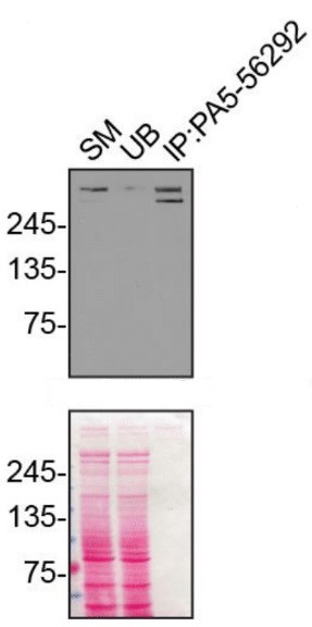 Plectin Antibody in Immunoprecipitation (IP)