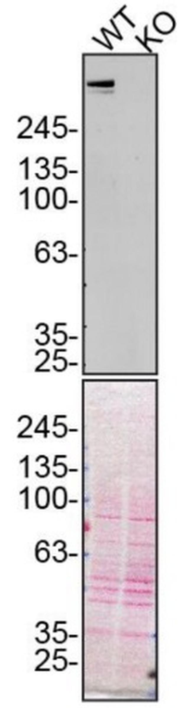 Plectin Antibody in Western Blot (WB)