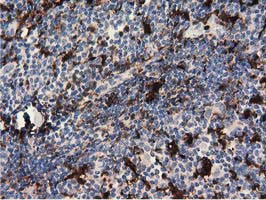 PLEK Antibody in Immunohistochemistry (Paraffin) (IHC (P))