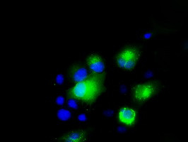 PMEL Antibody in Immunocytochemistry (ICC/IF)