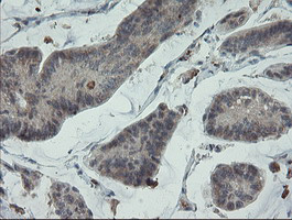 PMEL Antibody in Immunohistochemistry (Paraffin) (IHC (P))