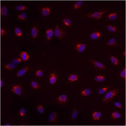 PMP70 Antibody in Immunocytochemistry (ICC/IF)