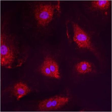 PMP70 Antibody in Immunocytochemistry (ICC/IF)