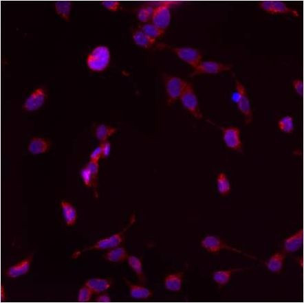 PMP70 Antibody in Immunocytochemistry (ICC/IF)