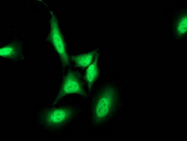 PNMT Antibody in Immunocytochemistry (ICC/IF)