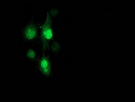 PNMT Antibody in Immunocytochemistry (ICC/IF)