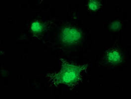 PNMT Antibody in Immunocytochemistry (ICC/IF)