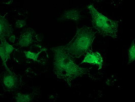 PNMT Antibody in Immunocytochemistry (ICC/IF)