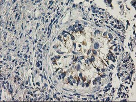 PNMT Antibody in Immunohistochemistry (Paraffin) (IHC (P))