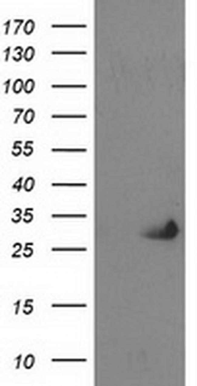 PNMT Antibody in Western Blot (WB)