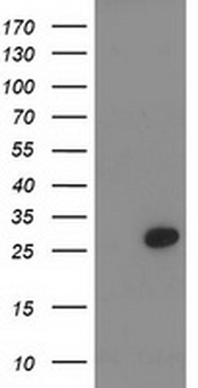 PNMT Antibody in Western Blot (WB)