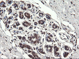 PNPO Antibody in Immunohistochemistry (Paraffin) (IHC (P))