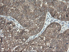 PNPO Antibody in Immunohistochemistry (Paraffin) (IHC (P))