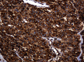 POGK Antibody in Immunohistochemistry (Paraffin) (IHC (P))