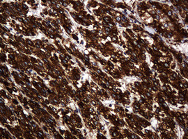 POGK Antibody in Immunohistochemistry (Paraffin) (IHC (P))