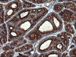 POGK Antibody in Immunohistochemistry (Paraffin) (IHC (P))