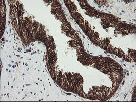 POGK Antibody in Immunohistochemistry (Paraffin) (IHC (P))