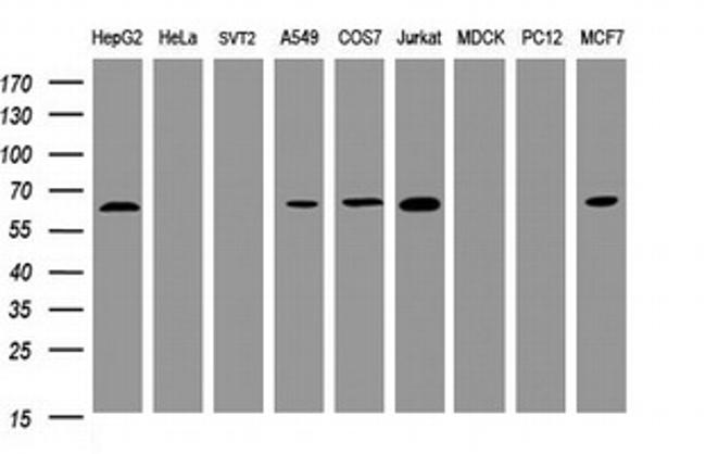 POGK Antibody in Western Blot (WB)