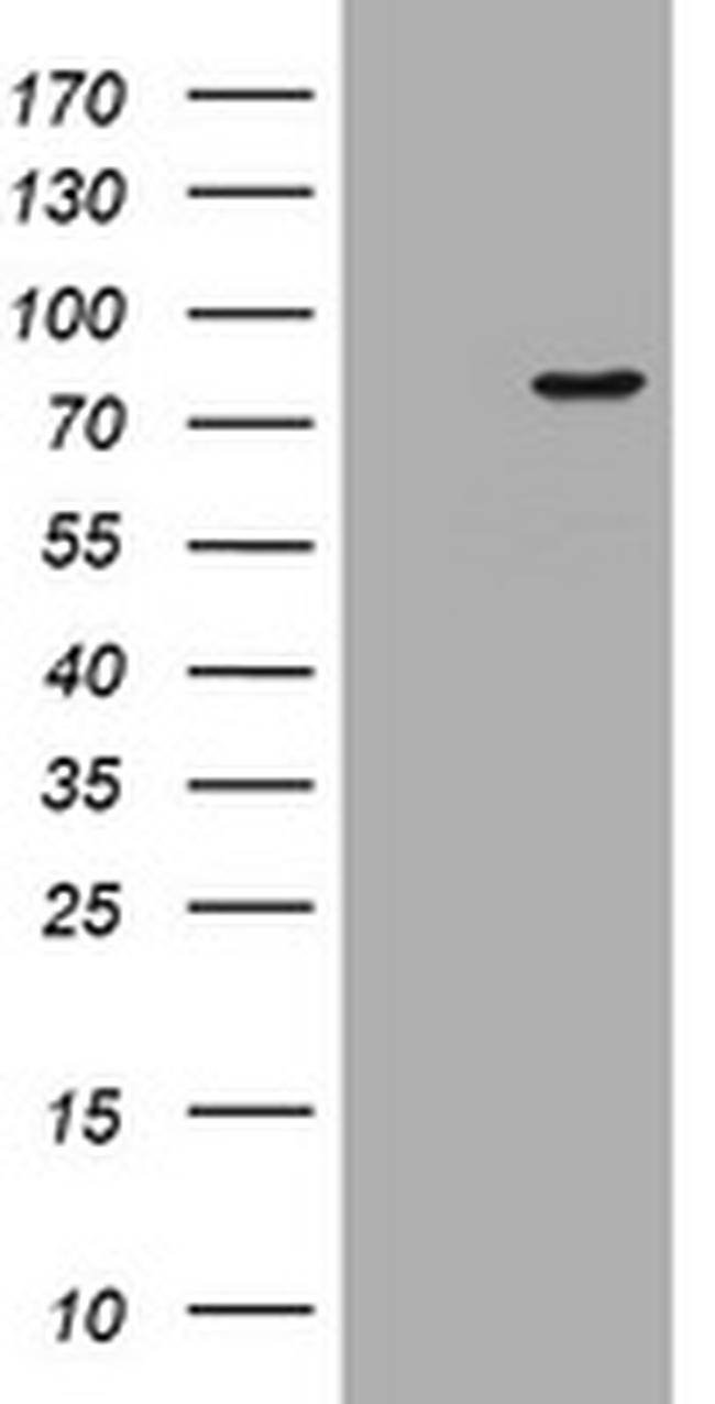 POGK Antibody in Western Blot (WB)