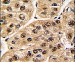 POLR1C Antibody in Immunohistochemistry (IHC)