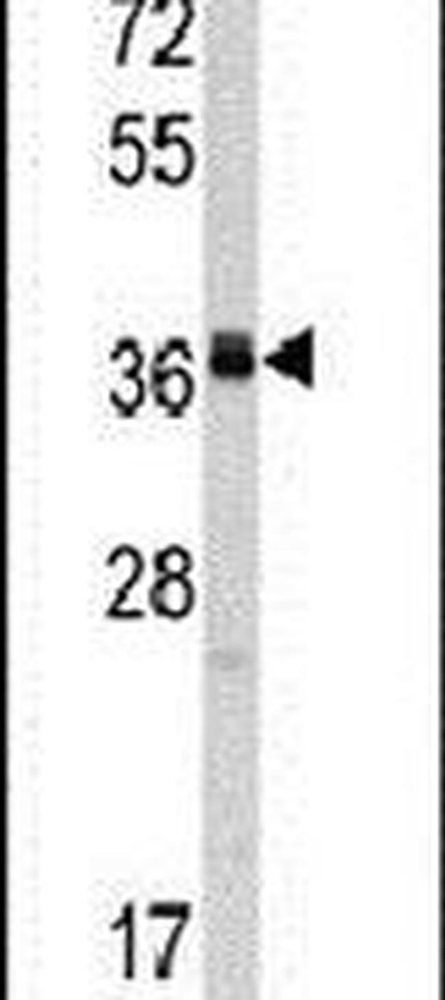 POLR1C Antibody in Western Blot (WB)