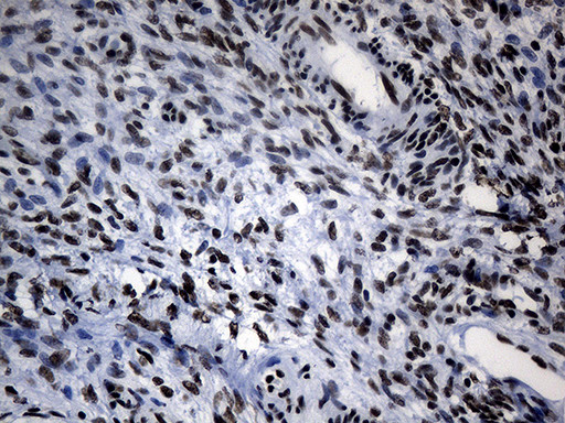 POLR2A Antibody in Immunohistochemistry (Paraffin) (IHC (P))