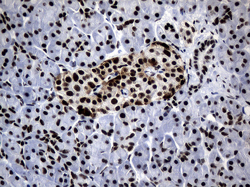 POLR2A Antibody in Immunohistochemistry (Paraffin) (IHC (P))