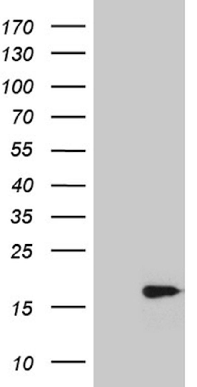 POLR2J Antibody in Western Blot (WB)