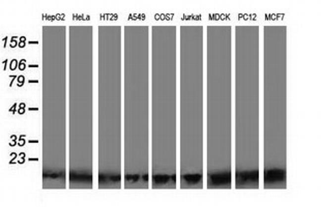 POLR2J2 Antibody in Western Blot (WB)