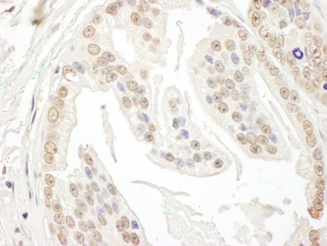 POLR3D Antibody in Immunohistochemistry (IHC)