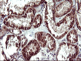 POLR3GL Antibody in Immunohistochemistry (Paraffin) (IHC (P))