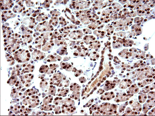 POLR3GL Antibody in Immunohistochemistry (Paraffin) (IHC (P))