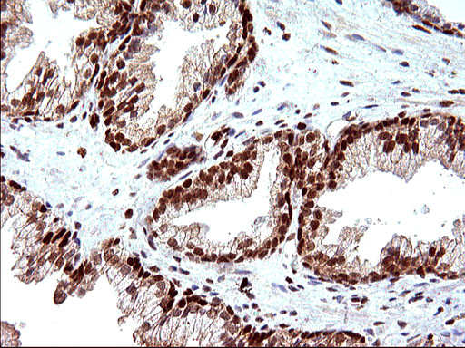 POLR3GL Antibody in Immunohistochemistry (Paraffin) (IHC (P))