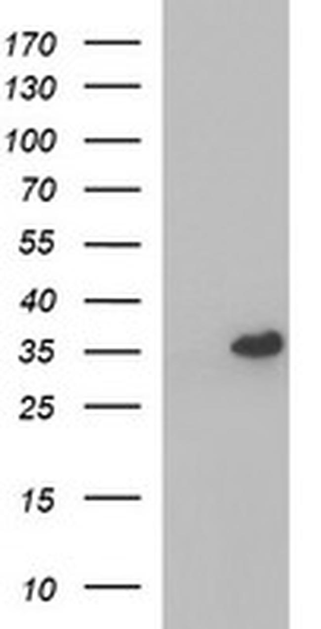 POLR3GL Antibody in Western Blot (WB)