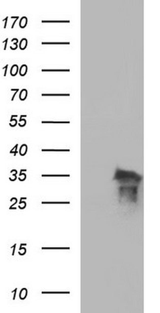 POLR3GL Antibody in Western Blot (WB)