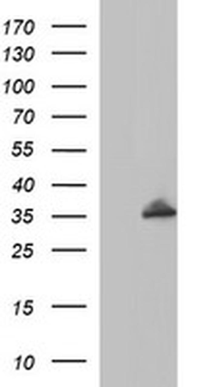 POLR3GL Antibody in Western Blot (WB)