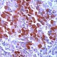 POMC Antibody in Immunohistochemistry (IHC)