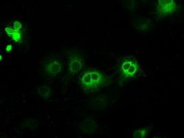 POR Antibody in Immunocytochemistry (ICC/IF)