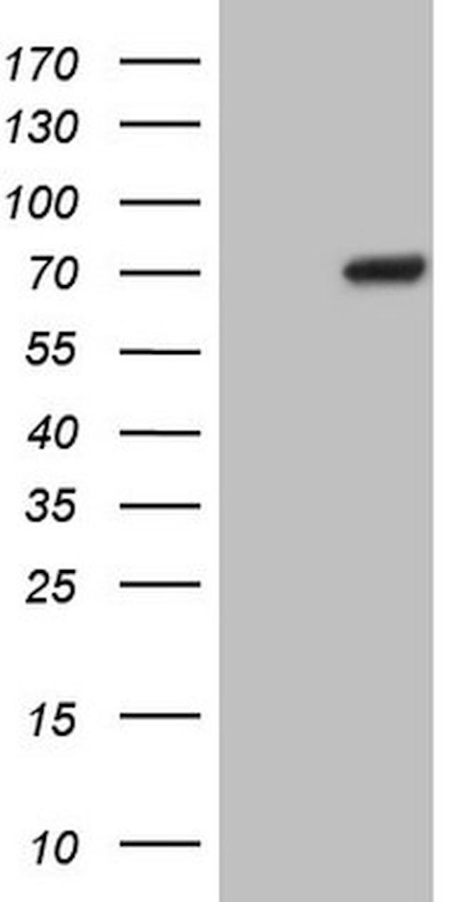POTEG Antibody in Western Blot (WB)