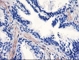 PPARA Antibody in Immunohistochemistry (Paraffin) (IHC (P))