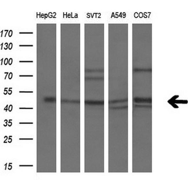 PPARA Antibody in Western Blot (WB)