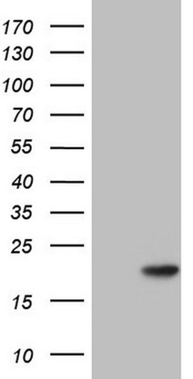 PPIL1 Antibody in Western Blot (WB)