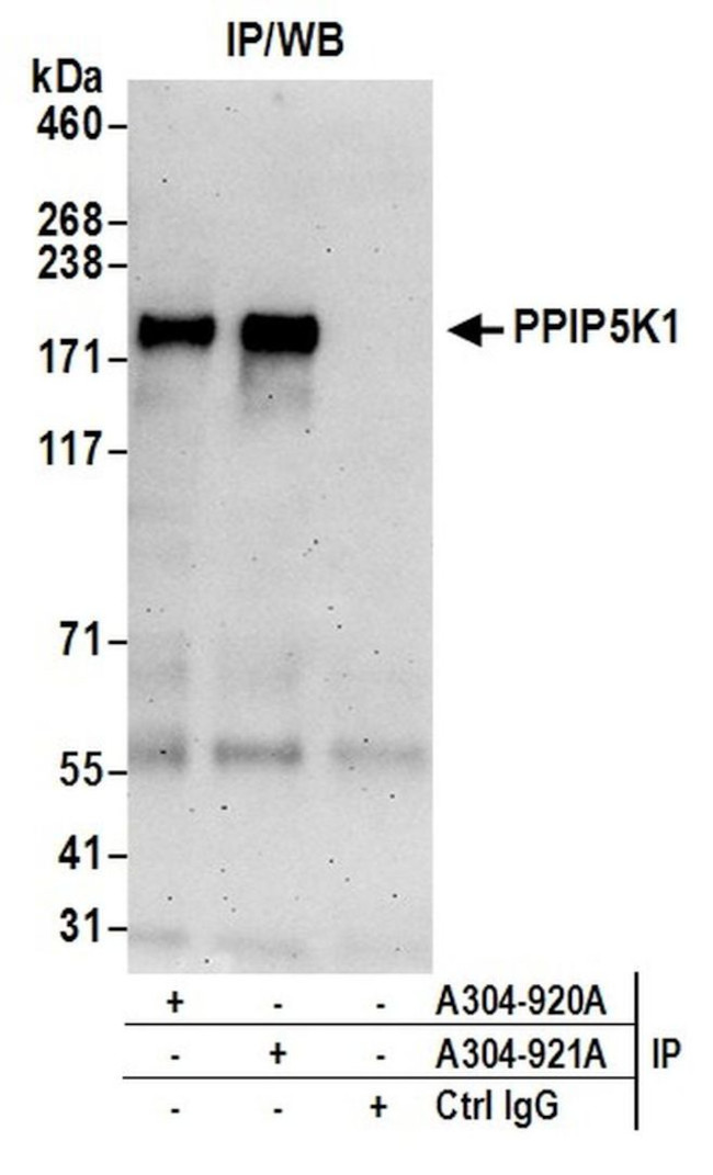 PPIP5K1/HISPPD2A Antibody in Immunoprecipitation (IP)