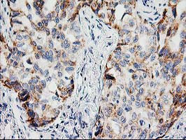 PPM1B Antibody in Immunohistochemistry (Paraffin) (IHC (P))