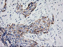 PPM1B Antibody in Immunohistochemistry (Paraffin) (IHC (P))