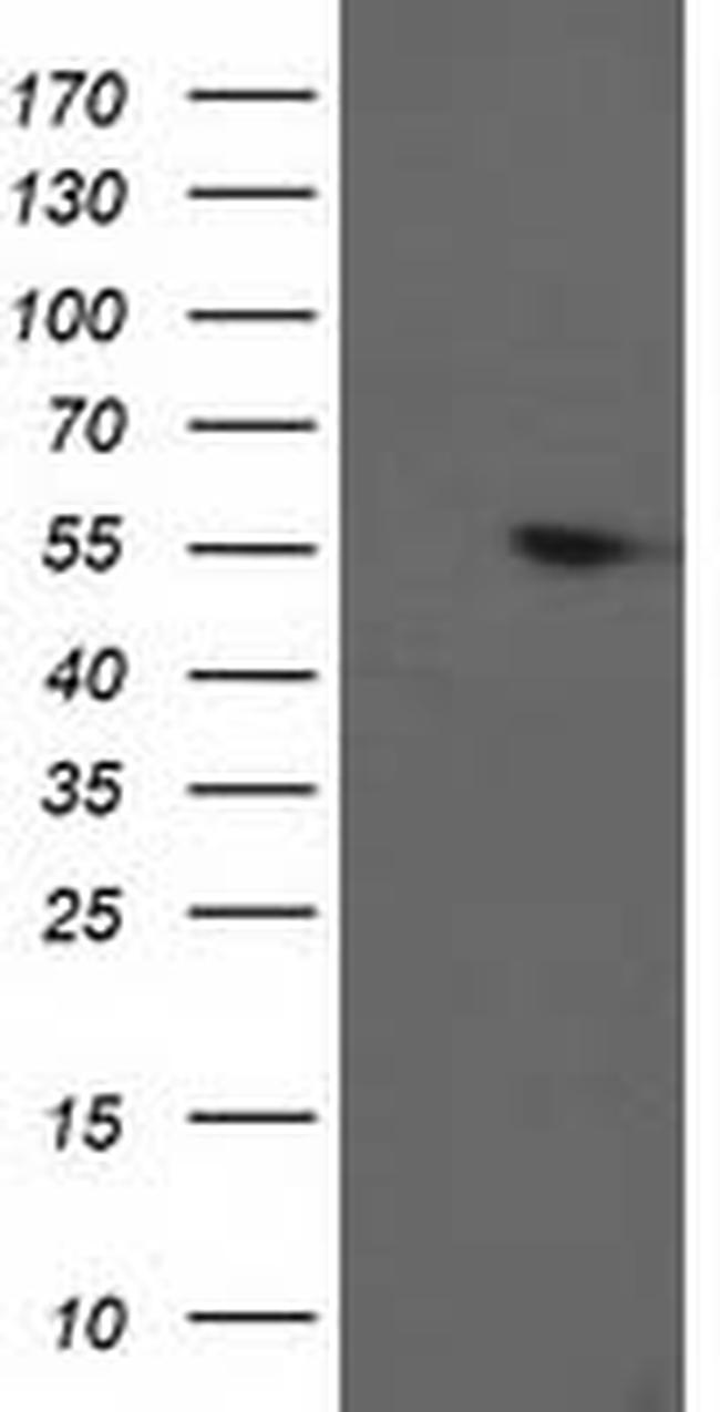 PPM1B Antibody in Western Blot (WB)