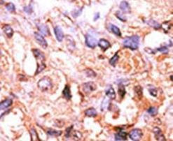 PPM1F Antibody in Immunohistochemistry (IHC)